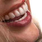 راه های داشتن دندان سالم و لبخند زیبا